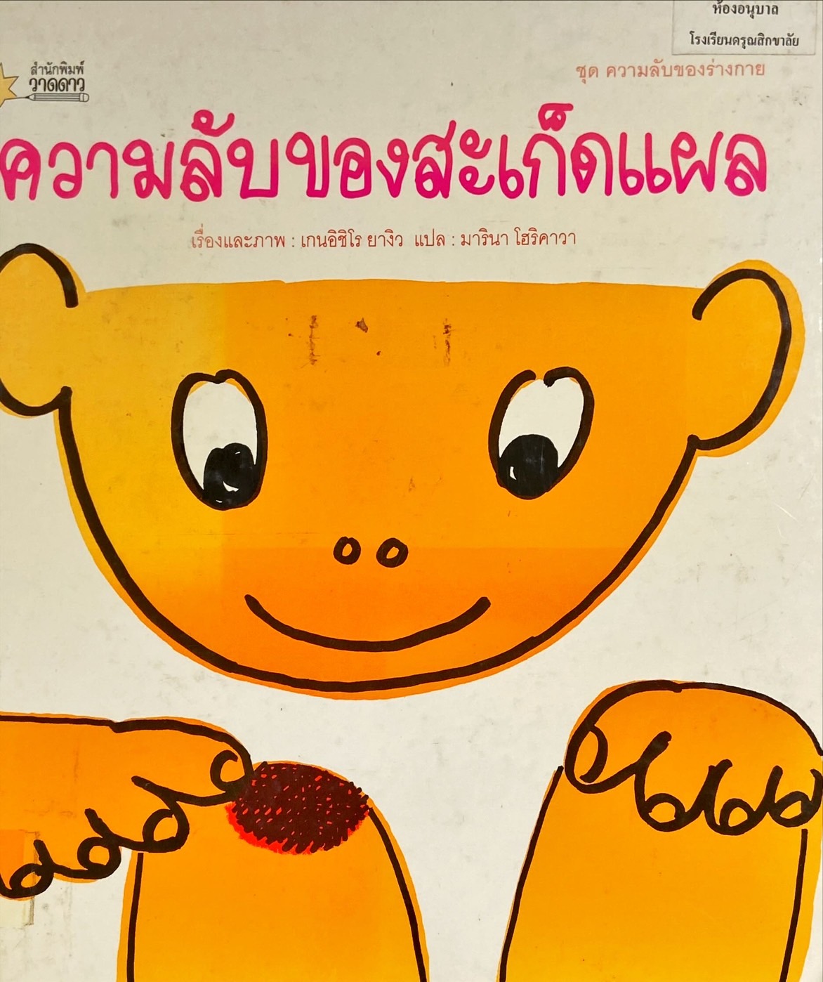 ความลับของสะเก็ดแผล